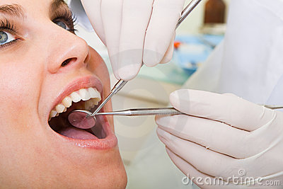 dental checkup